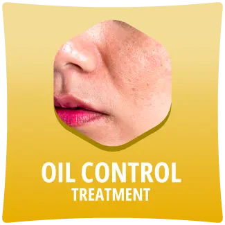 Oil Control Treatment